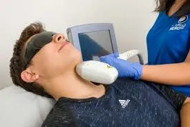 Depilación láser masculina: evolución progresiva del vello y la piel